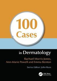 Cover image for 100 Cases in Dermatology