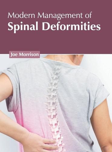 Cover image for Modern Management of Spinal Deformities