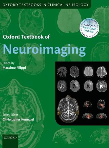 Cover image for Oxford Textbook of Neuroimaging