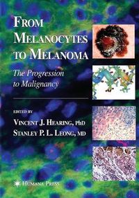 Cover image for From Melanocytes to Melanoma: The Progression to Malignancy