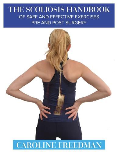 Cover image for The Scoliosis Handbook of Safe and Effective Exercises Pre and Post Surgery