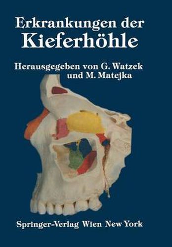 Cover image for Erkrankungen Der Kieferhoehle: Symposium, Fuschl, 26.-29. September 1985