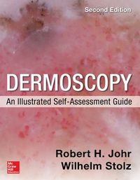 Cover image for Dermoscopy: An Illustrated Self-Assessment Guide, 2/e