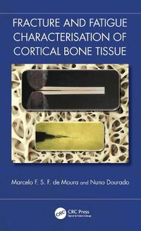 Cover image for Fracture and Fatigue Characterisation of Cortical Bone Tissue