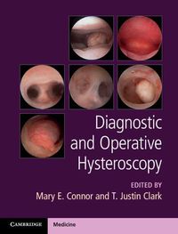 Cover image for Diagnostic and Operative Hysteroscopy