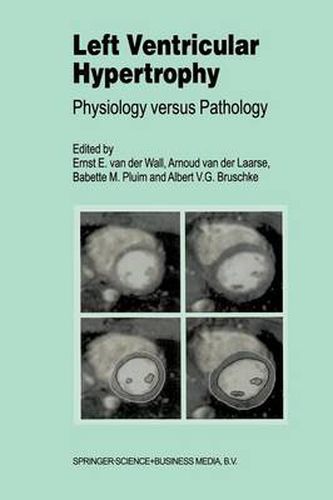 Left Ventricular Hypertrophy: Physiology versus Pathology