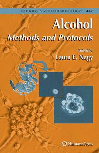 Cover image for Alcohol: Methods and Protocols