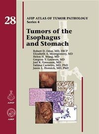 Cover image for Tumors of the Esophagus and Stomach