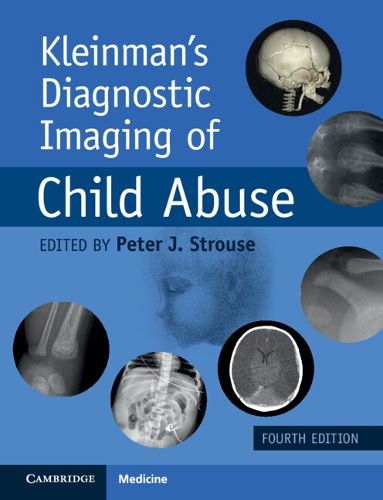 Cover image for Kleinman's Diagnostic Imaging of Child Abuse