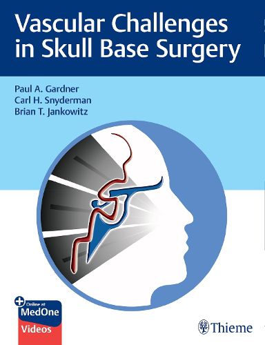 Cover image for Vascular Challenges in Skull Base Surgery