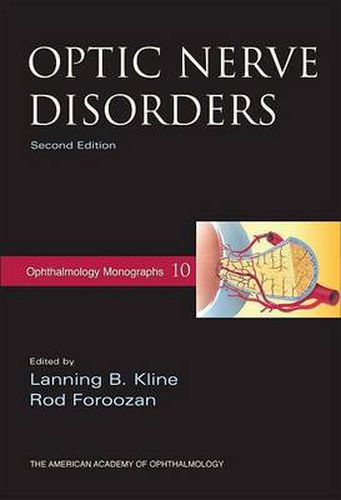 Cover image for Optic Nerve Disorders