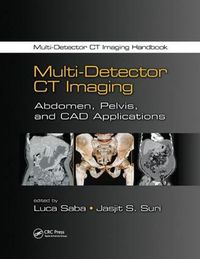 Cover image for Multi-Detector CT Imaging: Abdomen, Pelvis, and CAD Applications