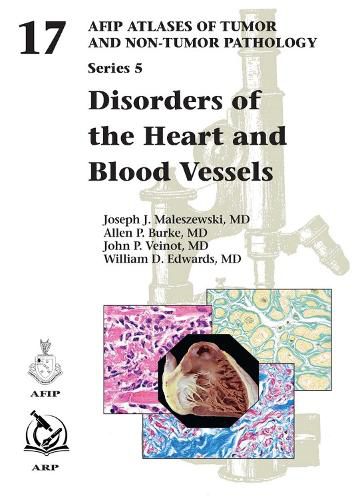 Cover image for Disorders of the Heart and Blood Vessels