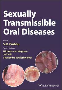 Cover image for Sexually Transmissible Oral Diseases