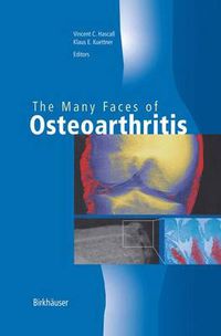 Cover image for The Many Faces of Osteoarthritis