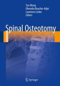 Cover image for Spinal Osteotomy