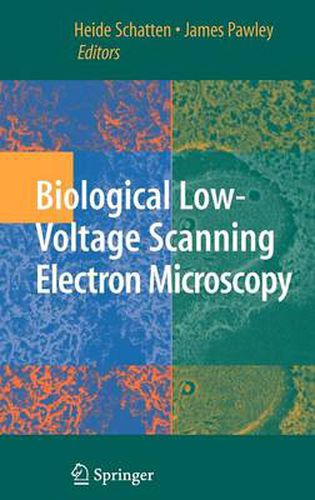Cover image for Biological Low-Voltage Scanning Electron Microscopy