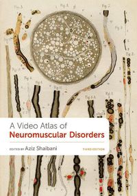 Cover image for A Video Atlas of Neuromuscular Disorders