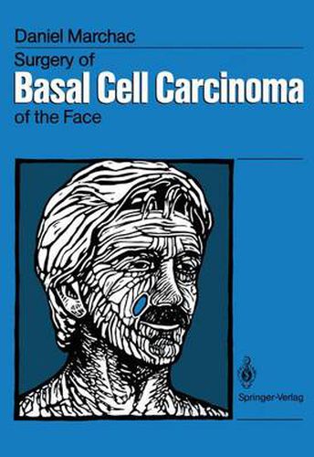 Cover image for Surgery of Basal Cell Carcinoma of the Face