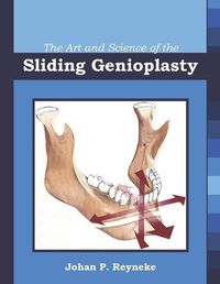 Cover image for The Art and Science of the Sliding Genioplasty