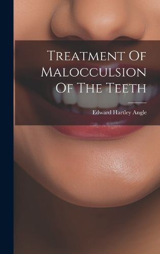 Cover image for Treatment Of Malocculsion Of The Teeth