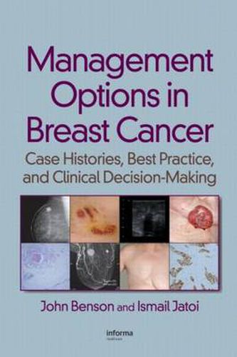 Cover image for Management Options in Breast Cancer: Case Histories, Best Practice, and Clinical Decision-Making