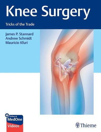 Cover image for Knee Surgery: Tricks of the Trade