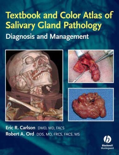 Cover image for Textbook and Color Atlas of Salivary Gland Pathology: Diagnosis and Management