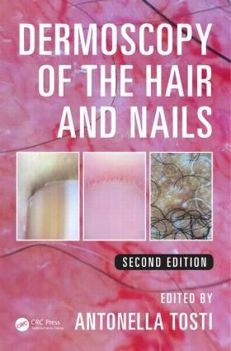 Cover image for Dermoscopy of the Hair and Nails
