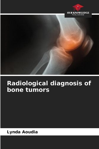 Cover image for Radiological diagnosis of bone tumors