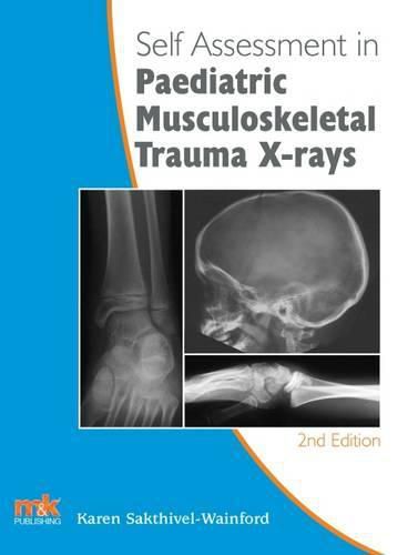 Cover image for Self-Assessment in Paediatric Musculoskeletal Trauma X-Rays