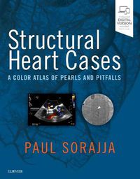 Cover image for Structural Heart Cases: A Color Atlas of Pearls and Pitfalls