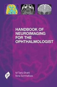 Cover image for Handbook of Neuroimaging for the Ophthalmologist