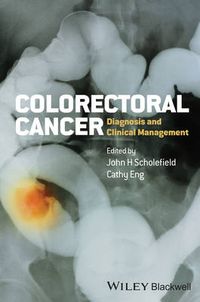 Cover image for Colorectal Cancer: Diagnosis and Clinical Management