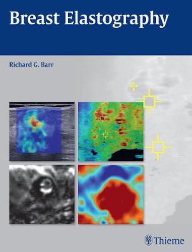 Cover image for Breast Elastography