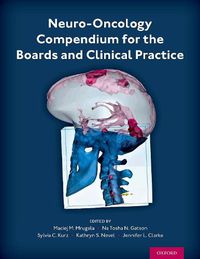 Cover image for Neuro-Oncology Compendium for the Boards and Clinical Practice