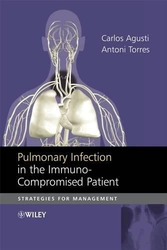 Cover image for Pulmonary Infection in the Immuno-compromised Patient: Strategies for Management