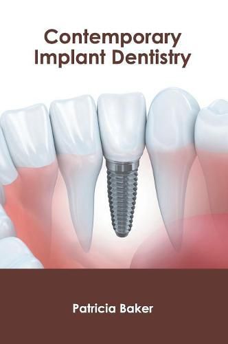 Cover image for Contemporary Implant Dentistry