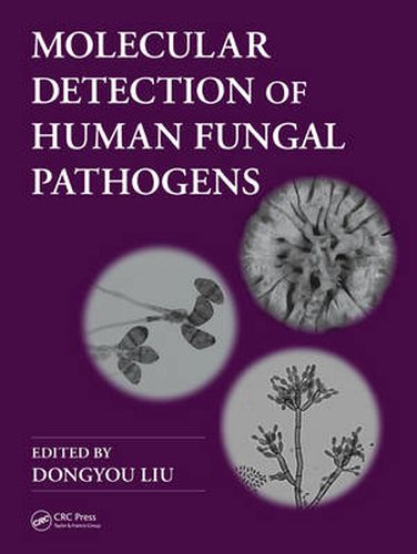Cover image for Molecular Detection of Human Fungal Pathogens