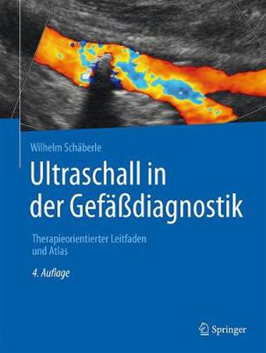 Cover image for Ultraschall in Der Gefassdiagnostik: Therapieorientierter Leitfaden Und Atlas