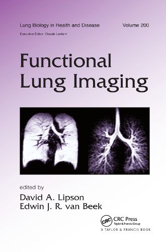 Cover image for Functional Lung Imaging