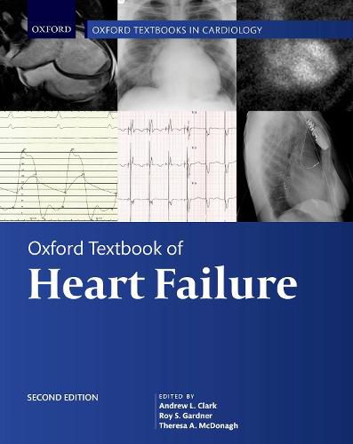 Cover image for Oxford Textbook of Heart Failure