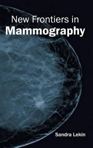 Cover image for New Frontiers in Mammography