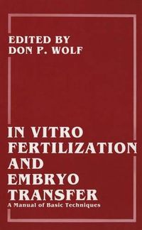 Cover image for In Vitro Fertilization and Embryo Transfer: A Manual of Basic Techniques