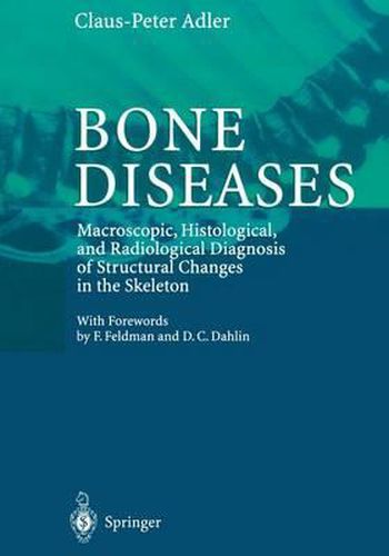 Bone Diseases