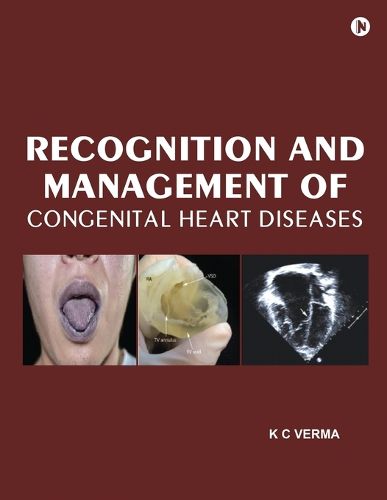 Cover image for Recognition and Management of Congenital Heart Diseases