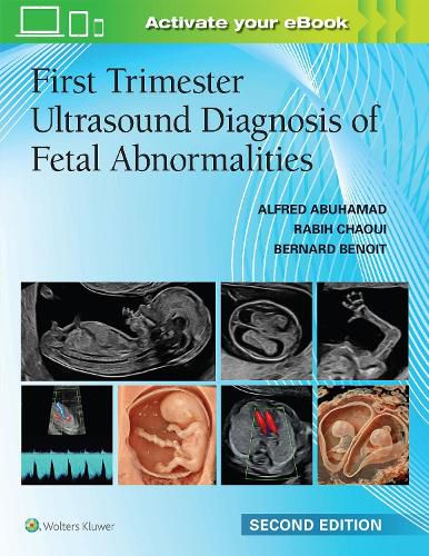 Cover image for First Trimester Ultrasound Diagnosis of Fetal Abnormalities