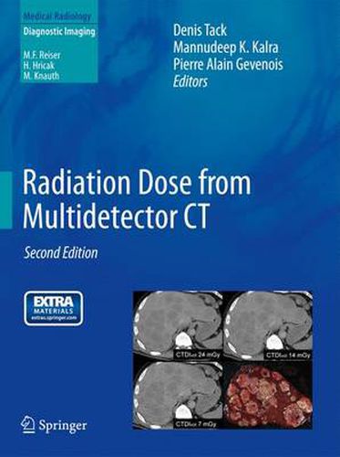 Cover image for Radiation Dose from Multidetector CT