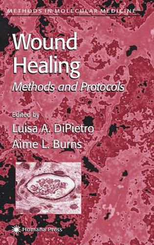 Cover image for Wound Healing: Methods and Protocols