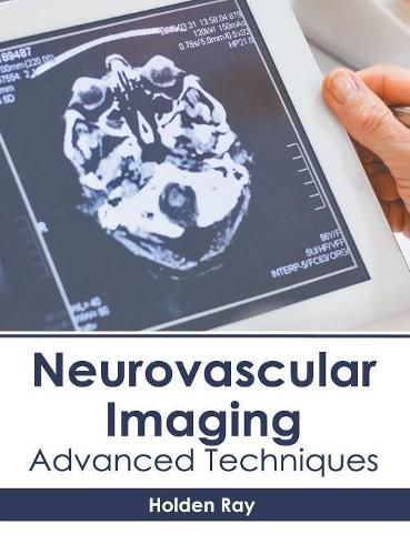 Cover image for Neurovascular Imaging: Advanced Techniques